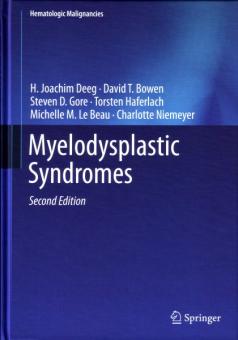 Myelodysplastic Syndromes 