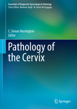 Pathology of the Cervix 