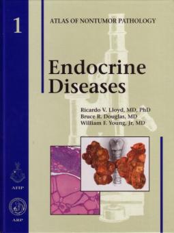 Endocrine Diseases 