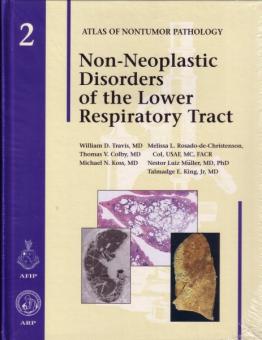 Non-Neoplastic Disorders of the Lower Respiratory Tract 