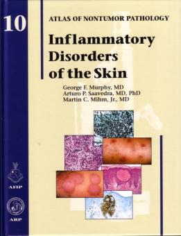 Inflammatory Disorders of the Skin 