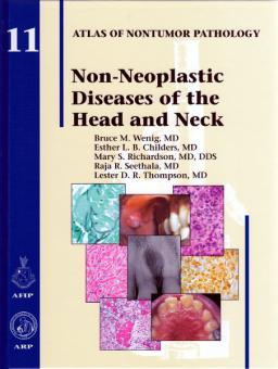 Non-Neoplastic Diseases of the Head and Neck 