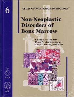 Non-Neoplastic Disorders of Bone Marrow 