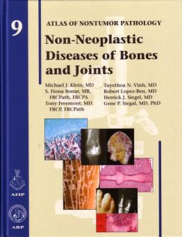 Non-Neoplastic Diseases of Bones and Joints 