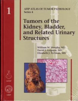 Tumors of the Kidney, Bladder and Related Urinary Structures 