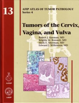 Tumors of the Cervix, Vagina and Vulva 