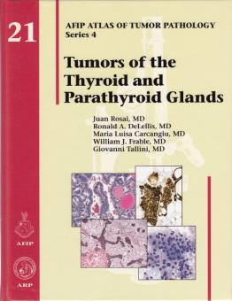 Tumors of the Thyroid and Parathyroid Glands 