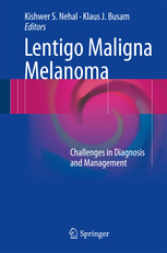 Lentigo Maligna Melanoma 
