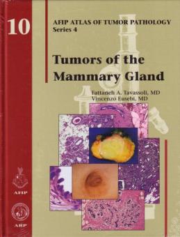 Tumors of the Mammary Gland 