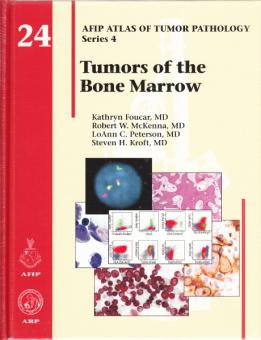 Tumors of the Bone Marrow 