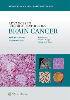 Advances in Surgical Pathology: Brain Cancer 
