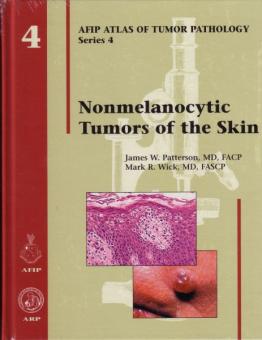 Nonmelanocytic Tumors of the Skin 