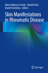 Skin Manifestations in Rheumatic Disease 