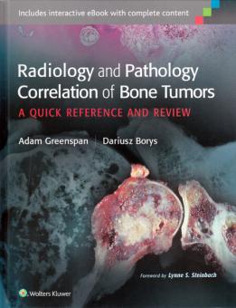 Radiology and Pathology Correlation of Bone Tumors 