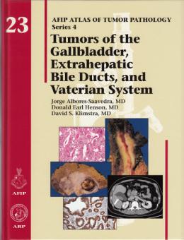 Tumors of the Gallbladder, Extrahepatic Bile Ducts and Vaterian System 