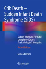 Crib Death - Sudden Infant Death Syndrome (SIDS) 