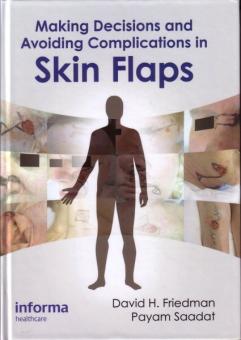 Making Decisions and Avoiding Complications in Skin Flaps 