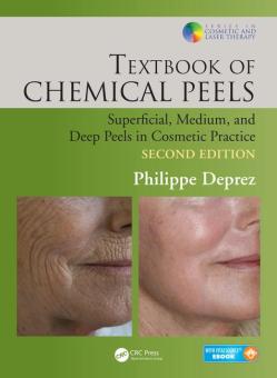 Textbook of Chemical Peels 