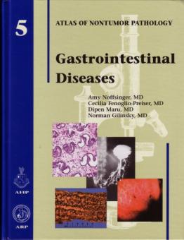 Gastrointestinal Diseases 