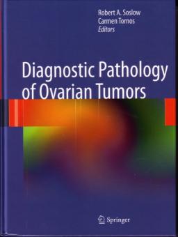 Diagnostic Pathology of Ovarian Tumors 