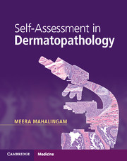 Self-Assessment in Dermatopathology 