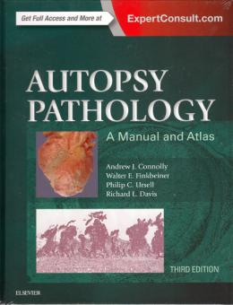 Autopsy Pathology 