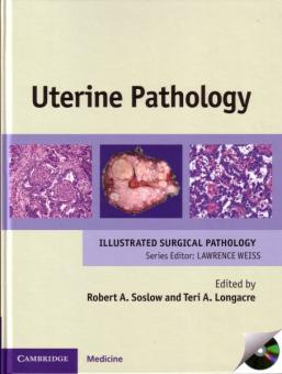 Uterine Pathology 
