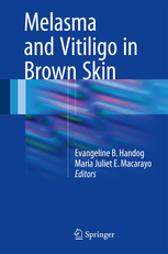 Melasma and Vitiligo in Brown Skin 