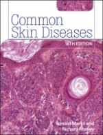 Common Skin Diseases 