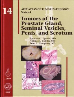 Tumors of the Prostate Gland, Seminal Vesicles, Penis and Scrotum 