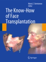 The Know-How of Face Transplantation 