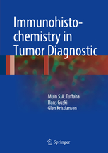 Immunohistochemistry in Tumor Diagnostic 
