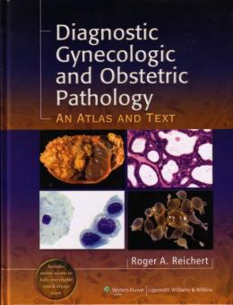 Diagnostic Gynecologic and Obstetric Pathology 