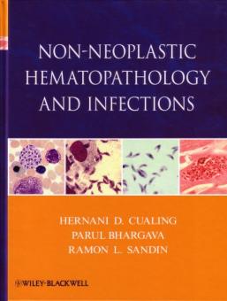 Non-Neoplastic Hematopathology and Infections 