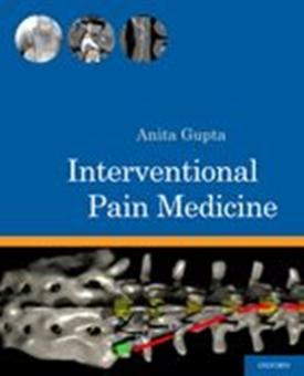 Interventional Pain Medicine 