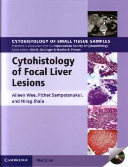 Cytohistology of Focal Liver Lesions 
