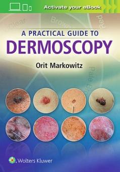 A Practical Guide to Dermoscopy 