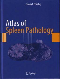 Atlas of Spleen Pathology 