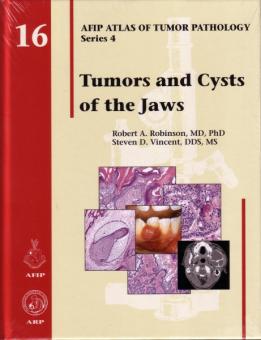 Tumors and Cysts of the Jaws 
