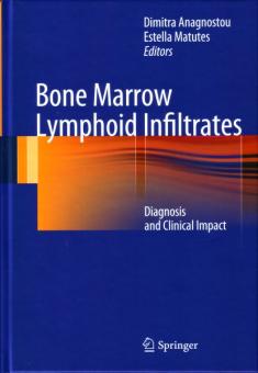 Bone Marrow Lymphoid Infiltrates 