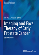 Imaging and Focal Therapy of Early Prostate Cancer 