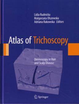 Atlas of Trichoscopy 
