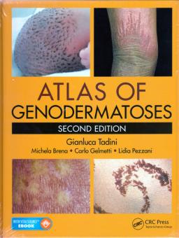Atlas of Genodermatoses 