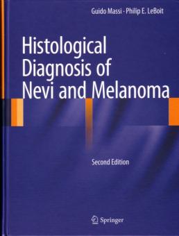 Histological Diagnosis of Nevi and Melanoma 