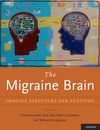 The Migraine Brain 