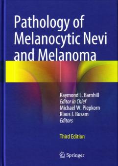 Pathology of Melanocytic Nevi and Melanoma 