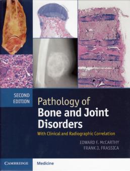 Pathology of Bone and Joint Disorders 
