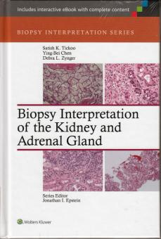 Biopsy Interpretation of the Kidney and Adrenal Gland 
