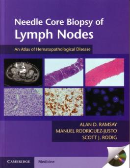Needle Core Biopsy of Lymph Nodes 