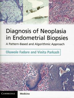 Diagnosis of Neoplasia in Endometrial Biopsies 